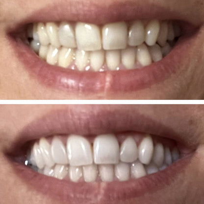 Bandes Blanchissantes Instantanées